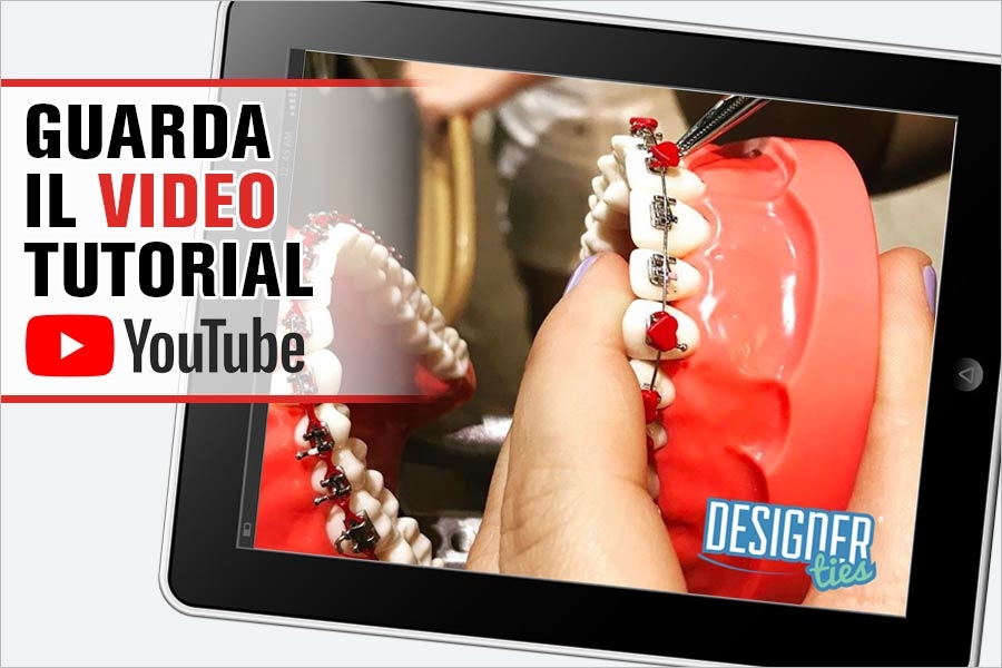 Visiona il video per l'applicazione delle legature Designer-Ties